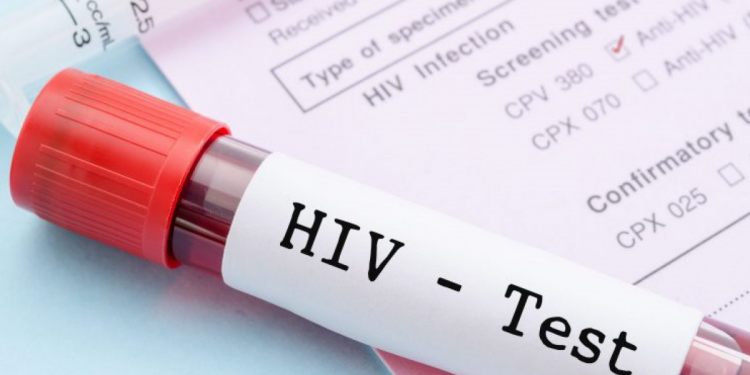 Agona East record 60 HIV/AIDS cases in 2022